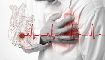 В чем разница между инсультом, инфарктом и остановкой сердца?